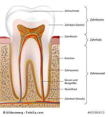 Was Ist Karies Ursachen Und Symptome Fur Zahnkaries