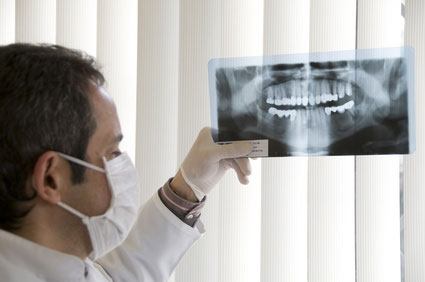 Zahnfistel röntgen